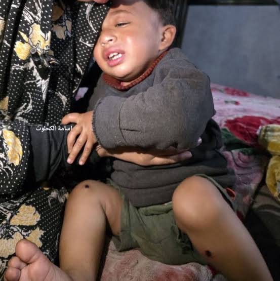 Palestinian toddler reportedly tortured