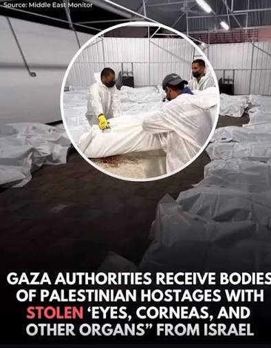 Allegations organ removal Gaza